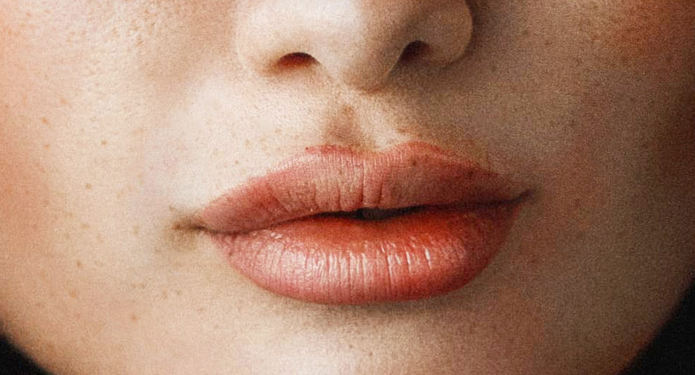 Close up of a woman's face with red plumpy lips after getting lip filler