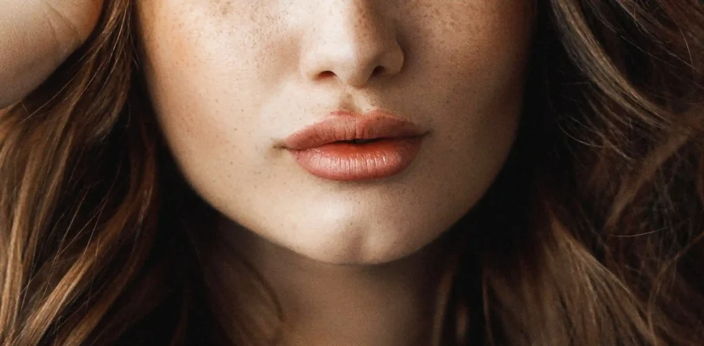 face treated with dermal filler- lips close up